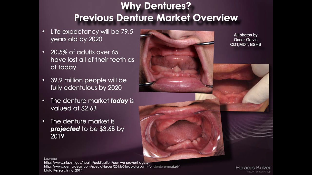 Complete Denture 1 - 1) Introduction