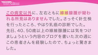 腺腫 乳腺 線維 乳腺症のしこりが石灰化したらどうなるの？痛みや検査、治療法について