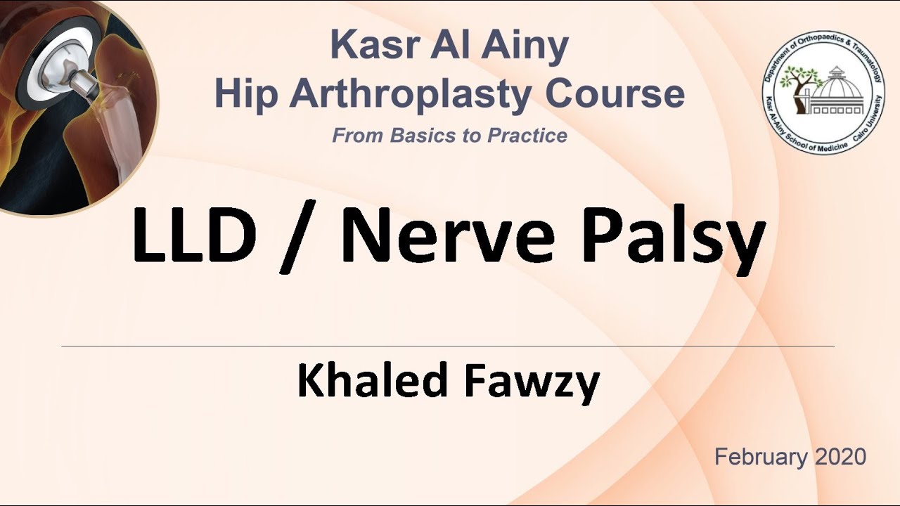 5-6 LLD Nerve Palsy - Khaled Fawzy