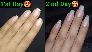 How to Grow Nails in 2 Days || How to Grow Nails Fast ||