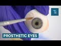 How Prosthetic Eyes Are Made And Fitted