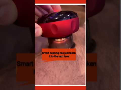 Smart Electric Cupping