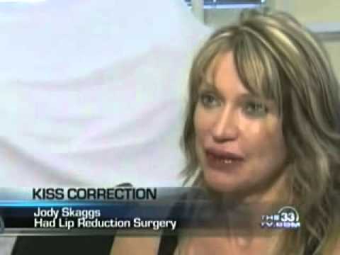 Lip Revision/Correction Story Featured on the CW 33 News