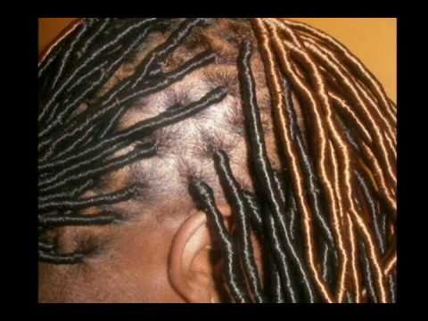 Beeper Braids / Alternative to locs- BH4U