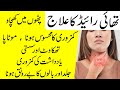 Thyroid ka ilaj  best diet for thyroid patient and home remedy  hypothyroid diet