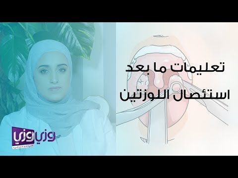 تعليمات ما بعد استئصال اللوزتين