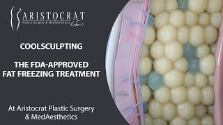 How CoolSculpting Works