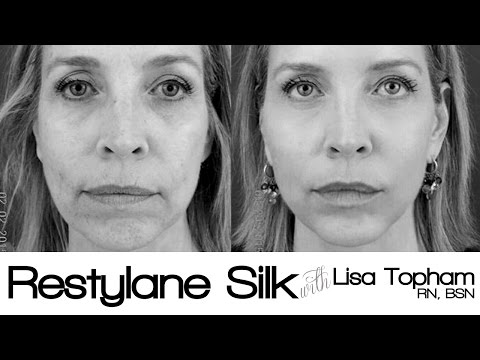 restylane-silk-–-lisa-topham,-rn,-bsn-&-director-of-split-rock-aesthetic-institute