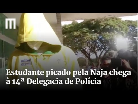 Estudante picado pela Naja chega à 14ª Delegacia de Polícia