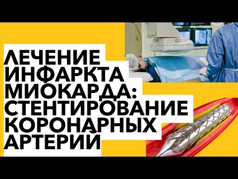 Лечение инфаркта миокарда: стентирование коронарных артерий