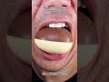 Satisfying Chewing ASMR #Compilation #ASMR #DoctorTristanPeh