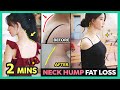 🔥2 MINS NECK HUMP REMOVAL EXERCISES | Correct Neck hump fat loss, Get rid of Buffalo hump