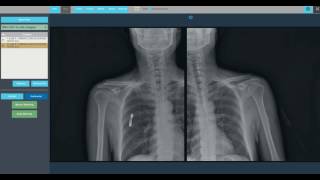 Auto Stitching for Both Shoulder