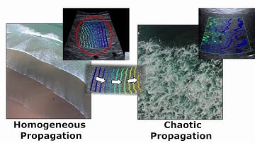 SWE Liver Fibrosis - Canon Medical Systems