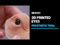 The new 3d printing technology revolutionising artificial eyes for patients  abc news