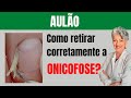 Aulão Como Retirar Onicofose Corretamente