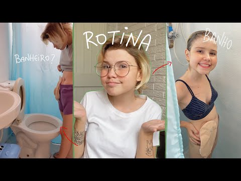 Vídeo: A Vida Com Uma Bolsa De Ostomia: A Opinião Honesta Deste Vlogger