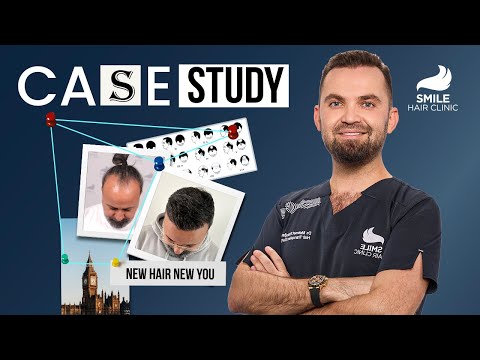 Case Study: 5300
