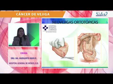 Vídeo: Carcinoma Metacrónico De Células Renales Con Metástasis En La Vejiga Urinaria Y órganos Distantes, 28 Años Después De La Nefrectomía Radical: Reporte De Un Caso