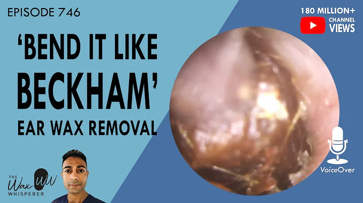 746 - 'Bend It Like Beckham' Ear Wax Removal