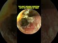 The Most Bizarre Expedition Into The Kingdom Of Fungi