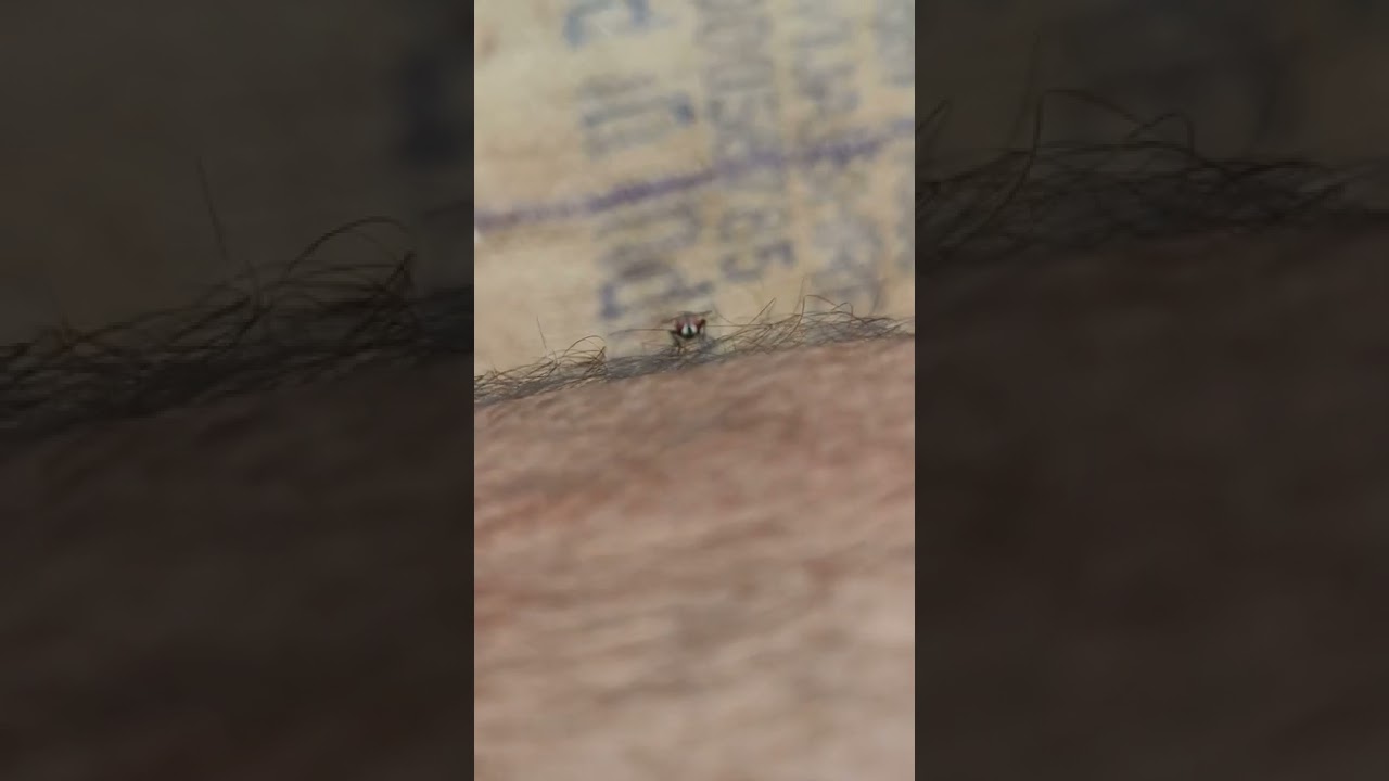 How Housefly Bites Human 🥰🥰😍😍