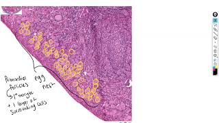 Histology of Ovary and Oviduct