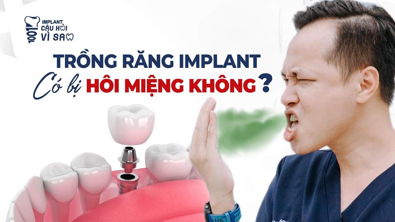 Outline Video MIỆNG BỐC MÙI không thể ngửi được SAU TRỒNG IMPLANT? NGUYÊN NHÂN thật sự là đây!