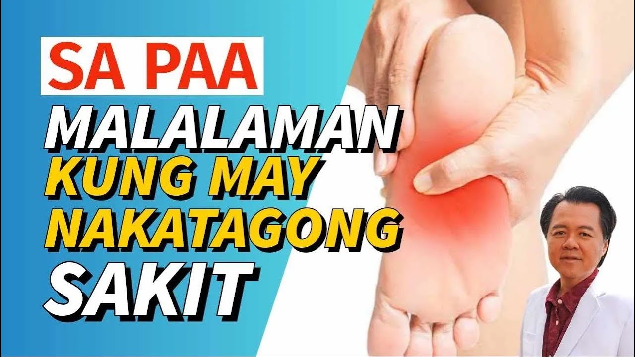 Sa Paa Pwede Makita kung may Nakatagong Sakit. - By Doc Willie Ong