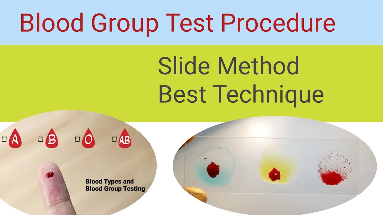 Blood Grouping By Slide Method Blood Group Test Procedure YouTube
