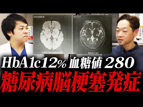【糖尿病通院の自己中断】大変なことになりました【現役糖尿病内科医】