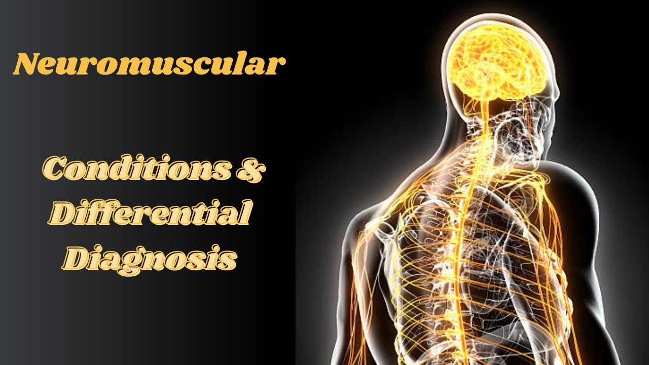 Neuromuscular NPTE Conditions and Differential Diagnosis with Practice Questions!