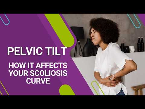 Pelvic Tilt: How It Affects Your Scoliosis Curve