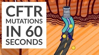 CFTR Cystic Fibrosis - 5 Mutation Classes