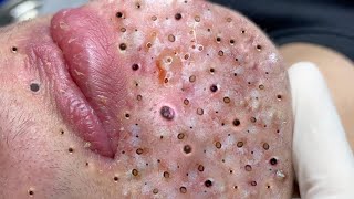 Relaxing Everyday With Loan Nguyen Skincare