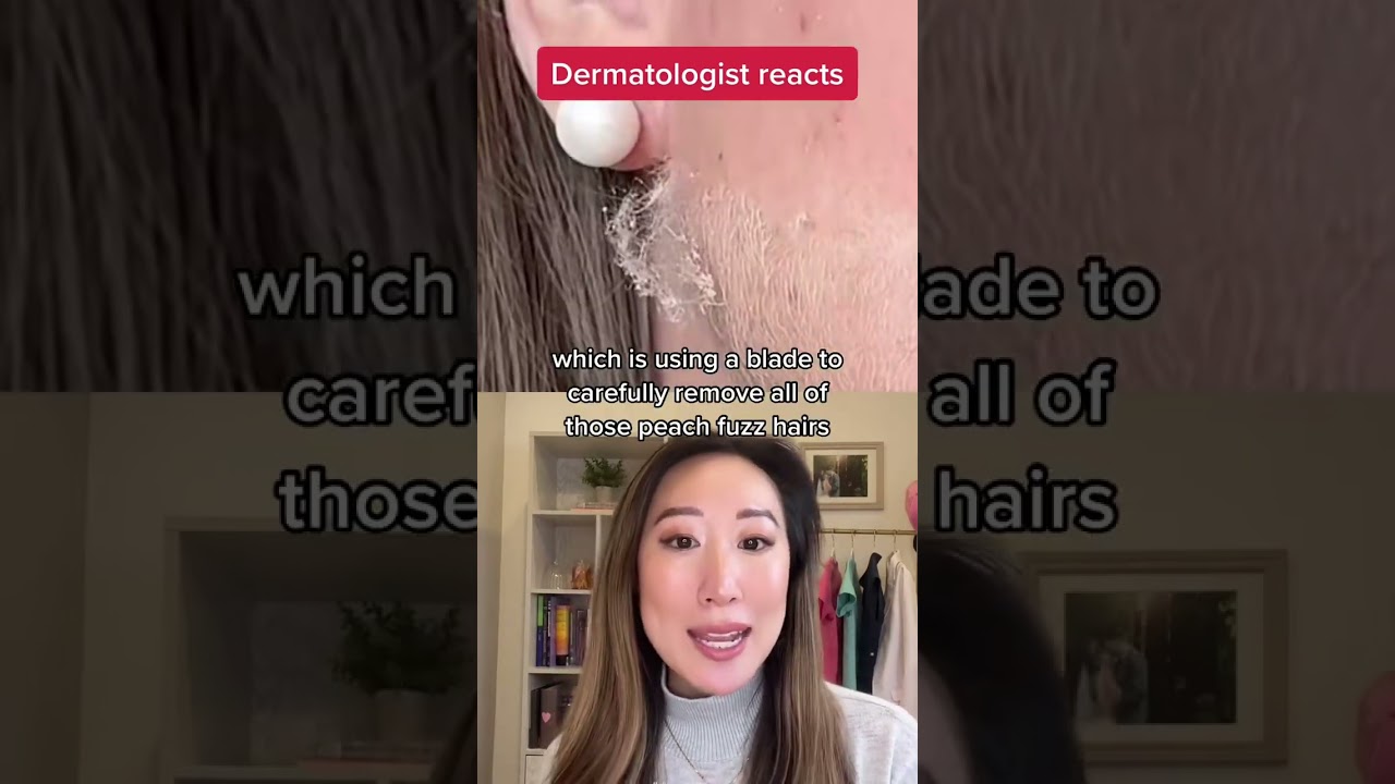 #дермапланинг