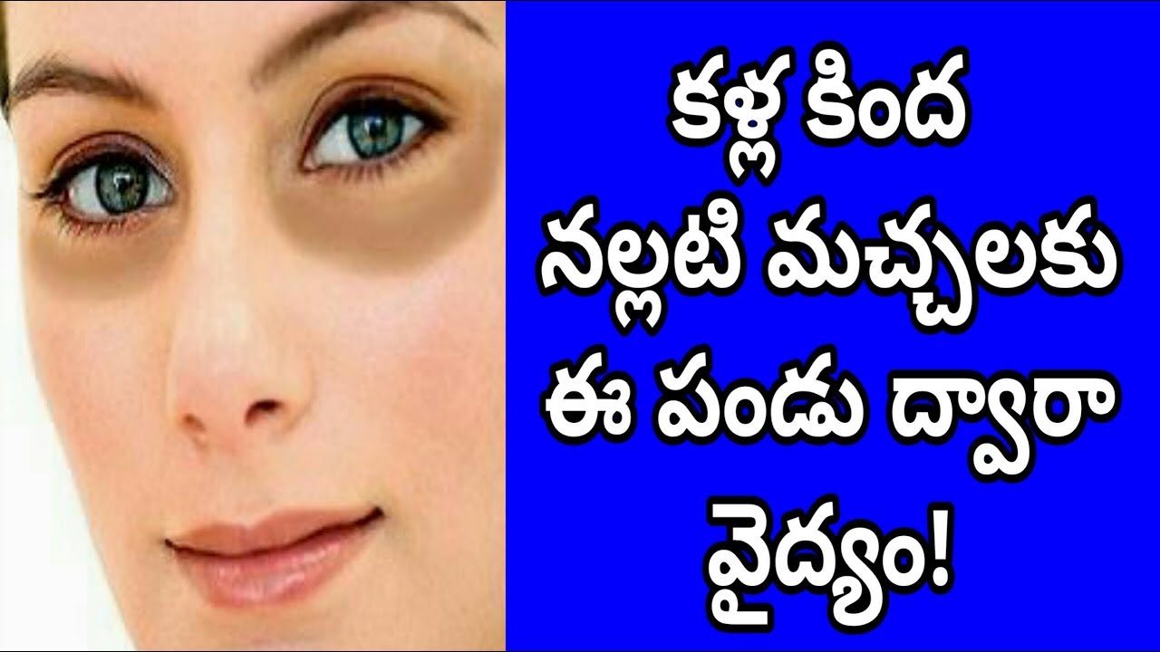 Magical Home Remedies To Remove Under Eye Dark Circles Instantly 100