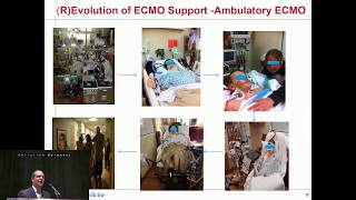 Update of ECMO Used as a Bridge to Heart or Lung Transplant