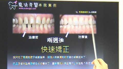 牙缝不能用补的是真的吗?潘韫珊 院长专访 - 天天要闻