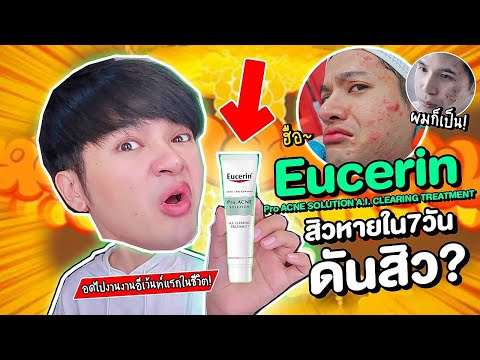 Eucerin ดันสิว! ยิ่งใช้ยิ่งเห่อ เจ็บแล้วจบมั้ย? อดไปงานอีเว้นแรกในชีวิต! l Superthankky