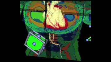 Patient Specific Modeling