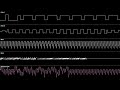 ○♪ Kirby’s Dreamland 2 - Cloudy Park [Oscilloscope View]