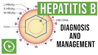 Hepatitis B: Overview, Clinical Presentation, Diagnosis and Management | Lecturio
