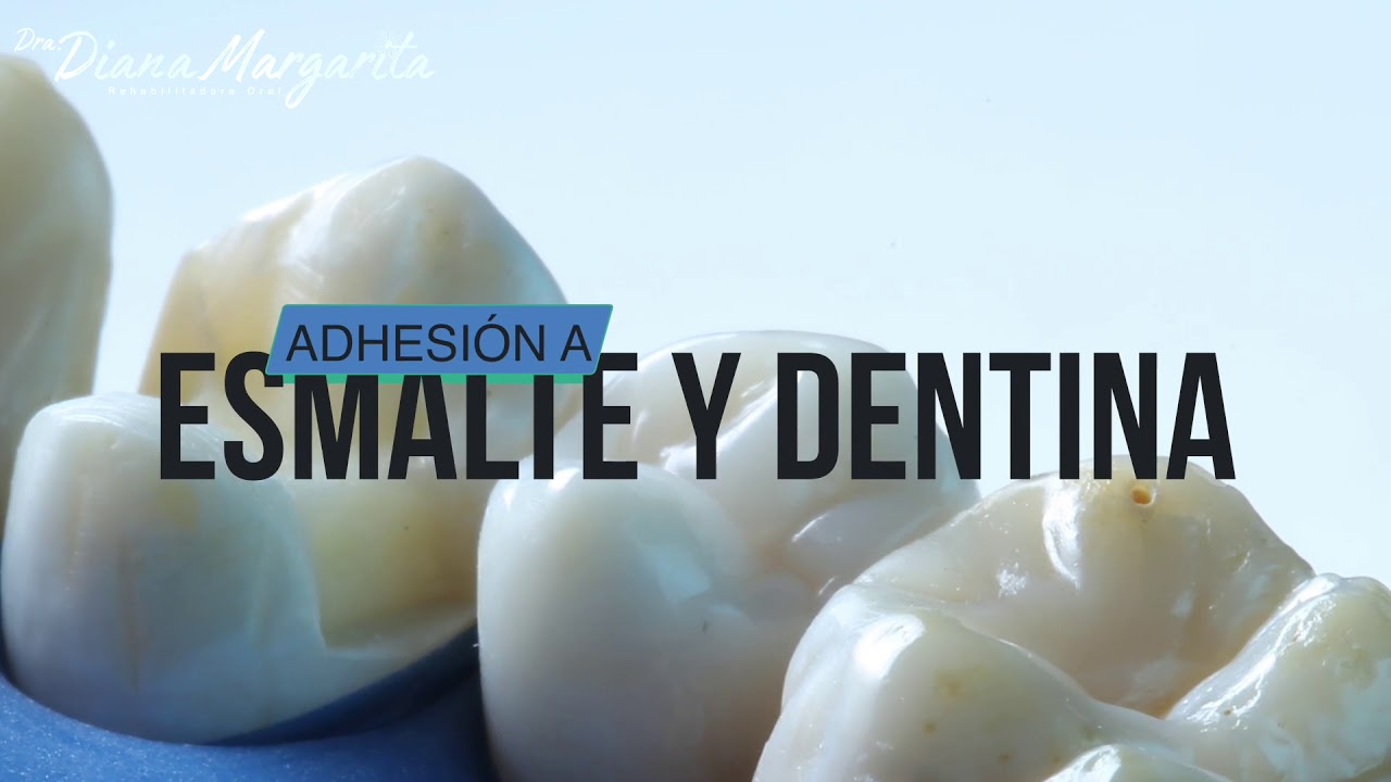 EN 5 MINUTOS. Repaso de adhesión a Esmalte y Dentina📖