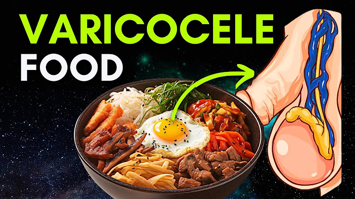 Best Foods for Varicocele | Follow this DIET if you have VARICOCELE #varicoceletreatment #diet