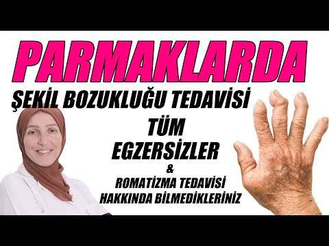 PARMAKLARDA ŞEKİL BOZUKLUĞU EGZERSİZLERİ / ROMATOİD ARTRİT /  KİREÇLENME / Fizyoterapist Aynur BAŞ