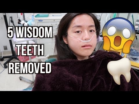 i-got-5-wisdom-teeth-removed-+-my-healing-process