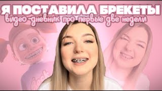 картинка: МОИ ПЕРВЫЕ ДВЕ НЕДЕЛИ С БРЕКЕТАМИ/уход за брекетами/что я ем и как справляюсь с дискомфортом?