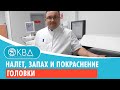 💣 Налет, запах и покраснение головки. Клинический случай №786