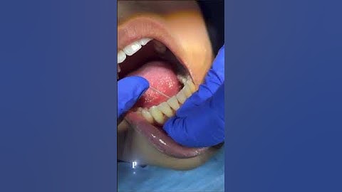 How To Floss #dentist  #smile #floss